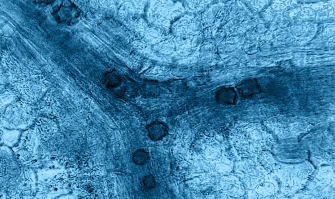 close up shot of plant cells in a microscope