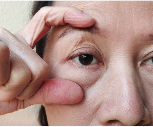 Woman holding her eye open