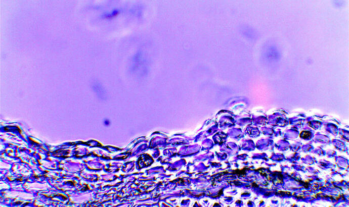 image of plant cells in a microscope