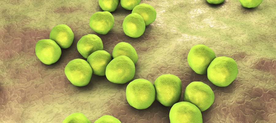 image of bright green orbs representing bacteria