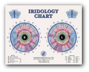 image of an iridology chart