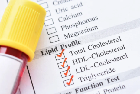 cholesterol panel