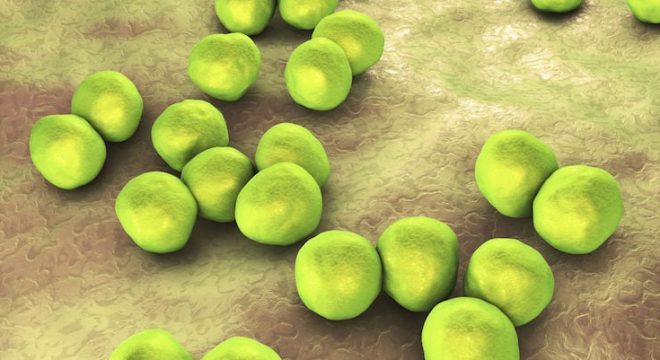 image of bright green orbs representing bacteria